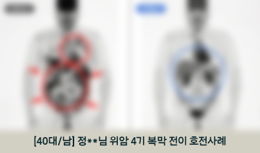 위암 통합암치료 후 NED상태, CIPN NRS 5->2, 복통 NRS 7->4, ECOG3->1, 체중 유지 호전후기