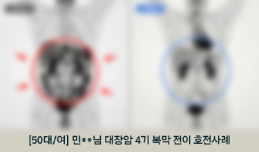 대장암 통합암치료 후 NED상태, CIPN NRS 4->3, 복통 NRS 5->1, ECOG2->1 호전후기
